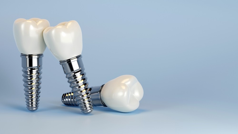 implant dentar București