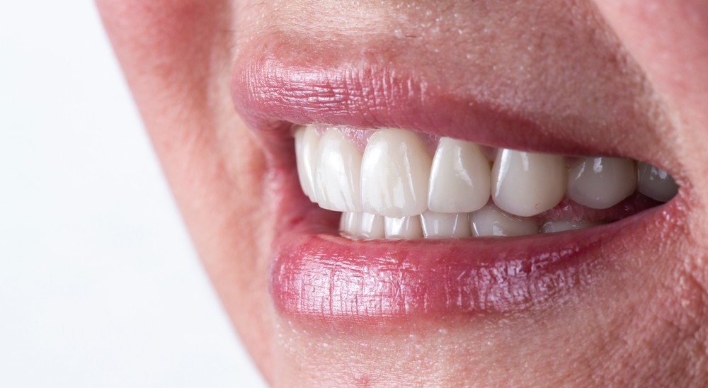 implant dentar bucuresti, implantologie bucuresti, art implant bucuresti