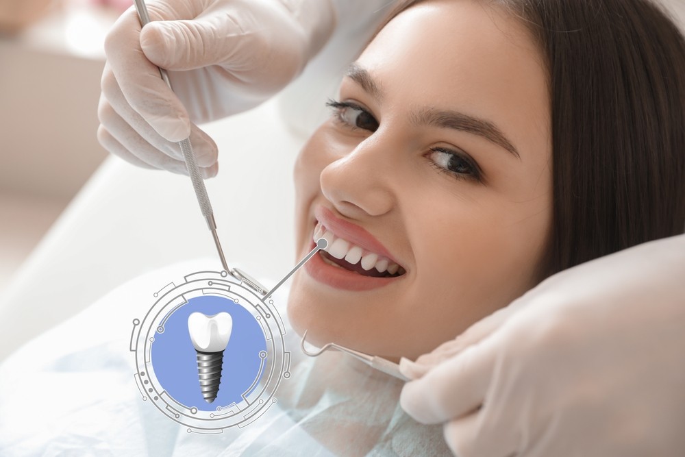 implant dentar București