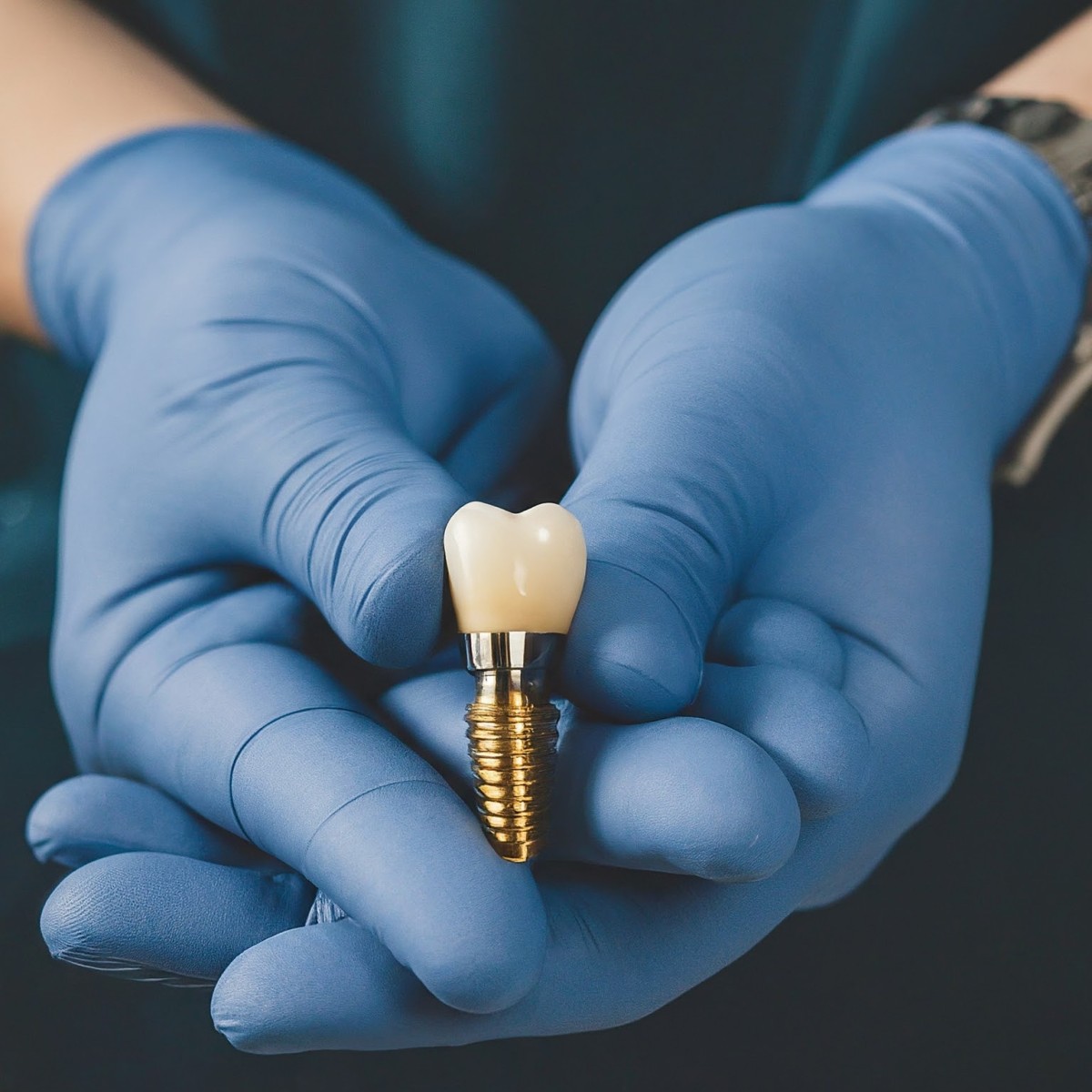 implant dentar în București